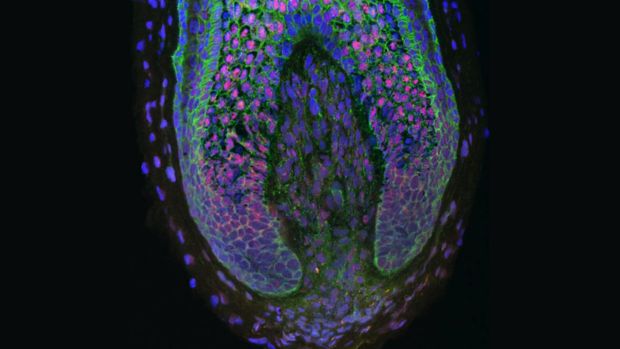 CUIMC Tissue Engineering of Human Hair Follicles