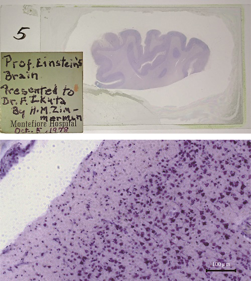 アインシュタインの脳切片 1955年以降 新潟大学脳研究所所蔵 写真撮影：カールツァイスマイクロスコピー株式会社